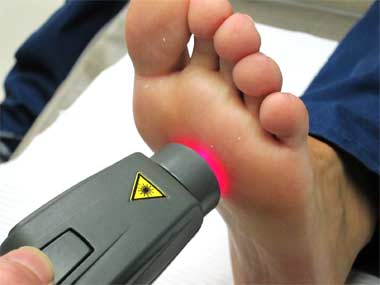 Laser Therapy on the Foot